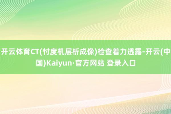 开云体育CT(忖度机层析成像)检查着力透露-开云(中国)Kaiyun·官方网站 登录入口